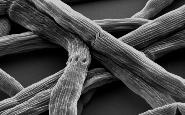 Kabelbakterium vergrößert